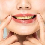 Cara Mencegah Noda Kuning Di Gigi Tanpa Pemutih Kimia