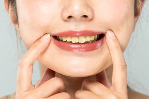 Cara Mencegah Noda Kuning Di Gigi Tanpa Pemutih Kimia